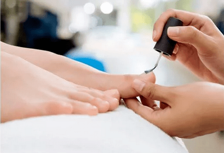 Мухи лакове