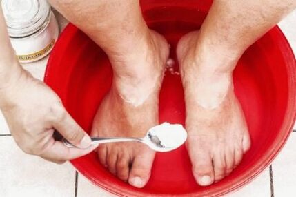 Лечение на гъбичката върху палеца на крака